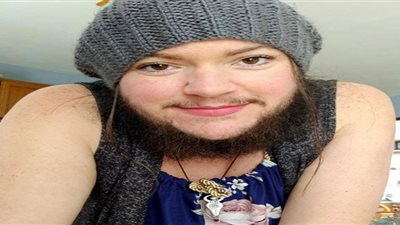 سيدة مفقودة تثير ضجة فى كندا.. والسبب 