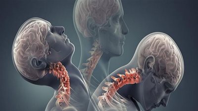 دراسة تكشف تأثير الضربات الرأسية بكرة القدم على الدماغ