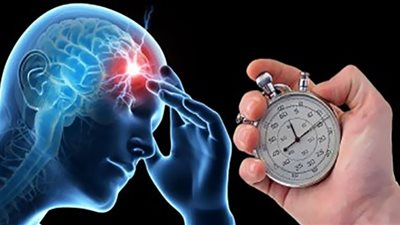 دراسة: ارتفاع الكولسترول يزيد خطر الإصابة بالسكتة الدماغية