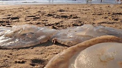 نصائح للتعامل مع لسعة قنديل البحر