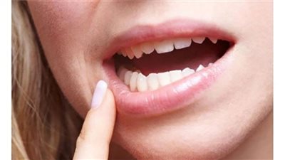 منها صعوبة البلع والنزيف.. أعراض سرطان الفم