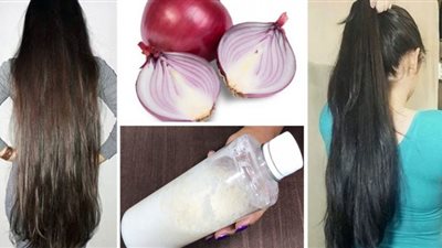 في أقل من شهر واحد.. طريقة عمل كريمة البصل لتطويل ومليء فراغات الشعر