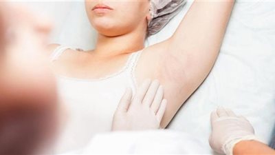 احذر.. ظهور هذه العلامات على الجلد تؤكد إصابتك بسرطان الدم