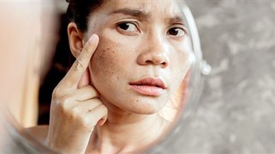 طبيبة تحذر: هذه الأطعمة تُسبب مرضًا لا علاج له