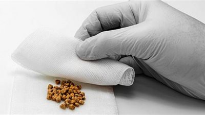 علاقة الطعام بحصوات المرارة