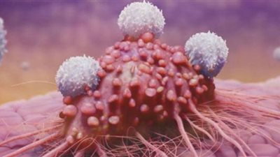 علامة مبكرة غير متوقعة للسرطان