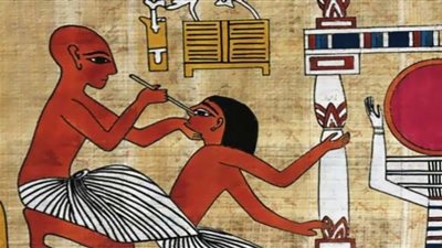 مفاجأة.. جراحات المخ الفرعونية تتفوق على الأدوية