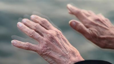 تغير خط اليد..علامات تدل على إصابتك بمرض باركنسون