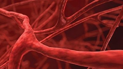 6 أنواع من منتجات تنظيف الشرايين