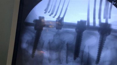 صحة البحر الأحمر: إجراء 6 عمليات كبرى ضمن مبادرة إنهاء قوائم الانتظار