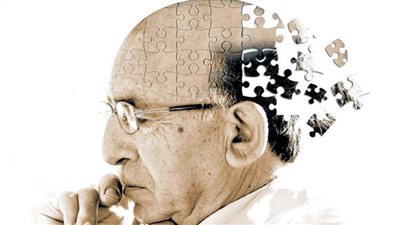 دواء جديد قادر على إبطاء تقدم ألزهايمر بنسبة 27%