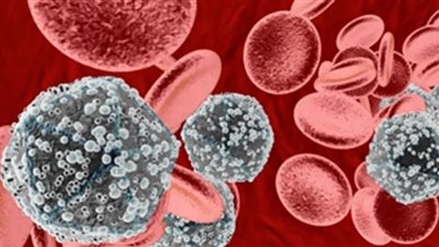 صدفة تقود الأطباء لعلاج محتمل للإيدز