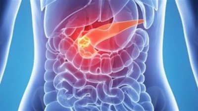 عادات بسيطة للوقاية من سرطان البنكرياس