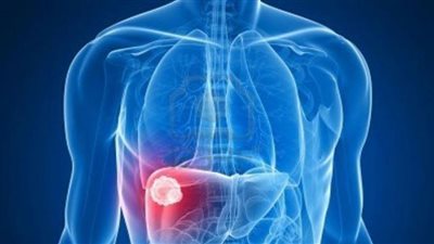 تحسين نمط النوم يحميك من مرض الكبد الدهني