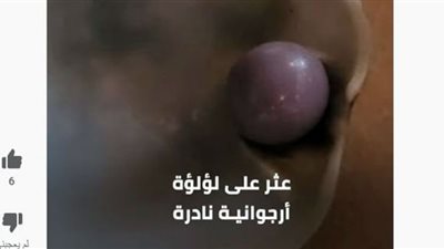 رجل يعثر على لؤلؤة أرجوانية في طعامه (شاهد)