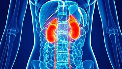 اخصائي تغذية يكشف الغذاء المثالي لصحة كليتك