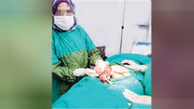 الإجهــاض.. ســوق ســوداء وأباطـرة طلــقاء