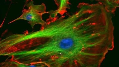 ابتكار مادة جديدة لمكافحة السرطان