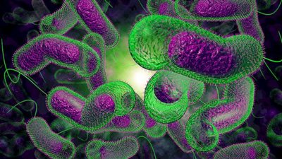 الأمم المتحدة تعلن وفاة 16 شخصًا بالكوليرا في هايتي