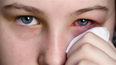 5 علامات في العين تكشف الإصابة بمرض قاتل