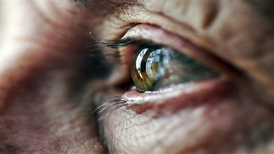 مواد غذائية تضاعف خطر الإصابة بالتنكس البقعي