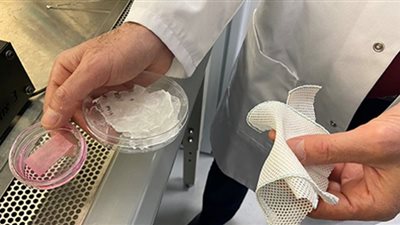 نجاح علاج عيب خلقي في القلب باستخدام الخلايا الجذعية