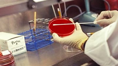 لون طعام شائع يزيد خطر الإصابة بأمراض خطيرة.. احذر