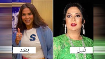 نوال الكويتية يتحول شكلها بعد خضوعها لعملية تجميل| صور