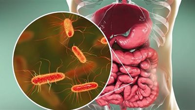 أعراض وأسباب الإصابة بالكوليرا