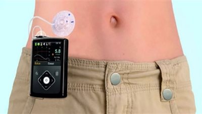 توزيع مضخات أنسولين مجانًا للأطفال المرضى بالدمرداش (فيديو)