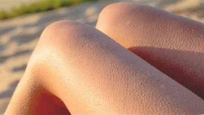 تخلصي من جلد الوزة واصنعي مقشر طبيعي بـ3 مكونات فقط