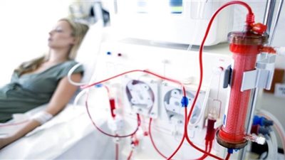 التفاصيل الكاملة لزيادة سعر جلسة الغسيل الكلوي