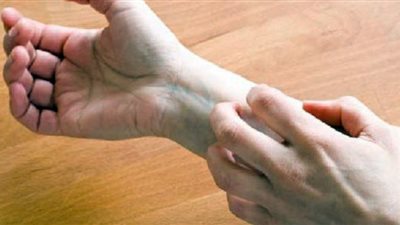 خطوات التعامل مع الإصابة بـ التينيا الملونة (إنفو جراف)
