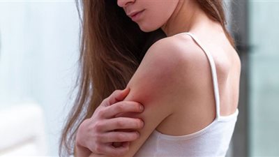 سرطان الجلد المُميت وارتفاع درجات الحرارة.. أطباء يحذرون من كارثة