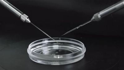 سر تراجع خصوبة الرجال عالميًا (فيديو)