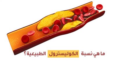 مواد غذائية تساعد على خفض مستوى الكوليسترول