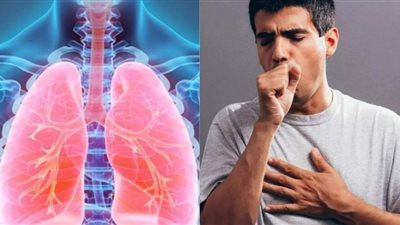هذه الفئات أكثر عرضة للإصابة بالفيروسات التنفسية في الشتاء
