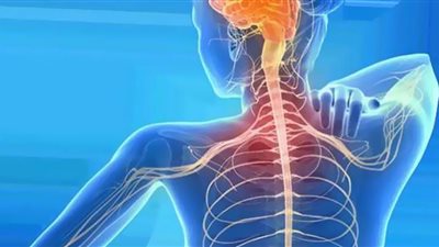مرض التصلب المتعدد.. الإرهاق واضطراب الأمعاء أبرز الأعراض