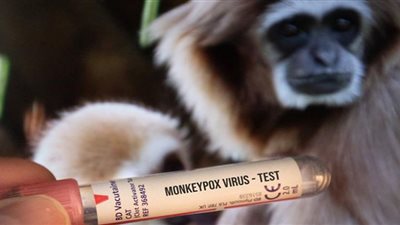 زيادة الإصابات 20%.. تطورات جدري القرود في العالم