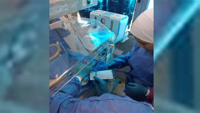 فحص 19 ألف طفل للكشف المبكر عن الأمراض الوراثية بالشرقية