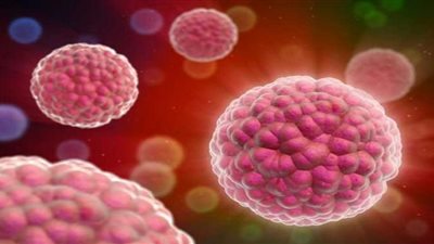 6 أسباب لتكاثر الخلايا السرطانية في الجسم (إنفوجراف)