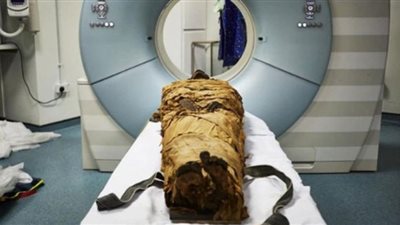 تشريح لمومياء طفل يكشف لغزا من القرن 17