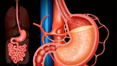 دواء للحموضة المعوية يتسبب في ارتفاع مخاطر الإصابة بسرطانات
