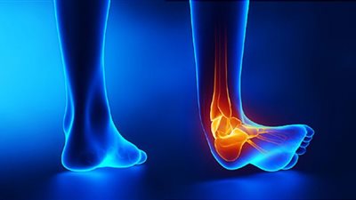 الأسباب الشائعة لآلام الساق