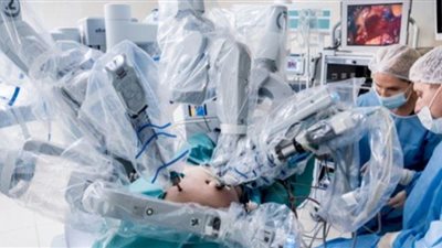 مستشفيات القصر العيني تستعين بالروبوت في عمليات القصور الكلوي.. فيديو