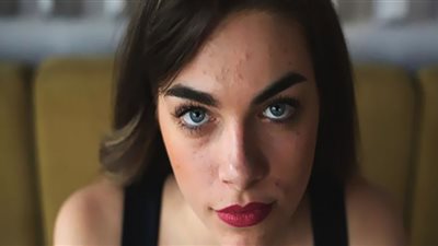 أبرزها الليمون.. مكونات طبيعية تؤذي البشرة