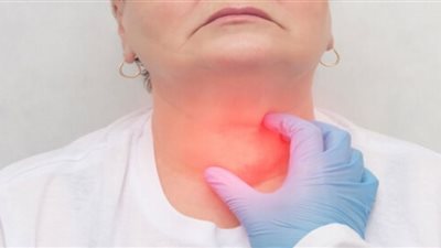 علامات تميز سرطان الغدة الدرقية.. طبيبة روسية تكشف