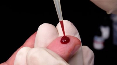 اختبار دم يكشف عن أنواع متعددة من السرطان في وقت مبكر