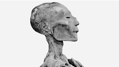 دمر روما وقتل ملك مصري.. جدري القرود 