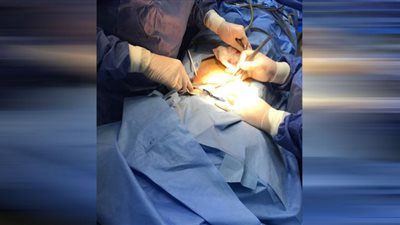 لأول مرة تركيب قسطرتين للغسيل البريتونى بمستشفى منية النصر المركزى